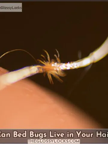 can bed bugs live in your hair