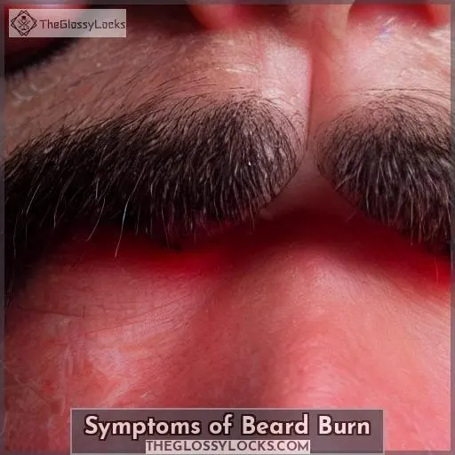 Symptoms of Beard Burn