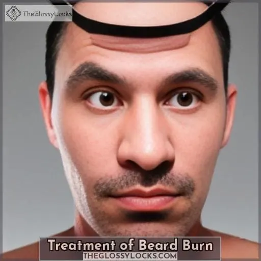 Treatment of Beard Burn
