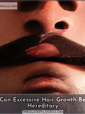 can excessive hair growth be hereditary
