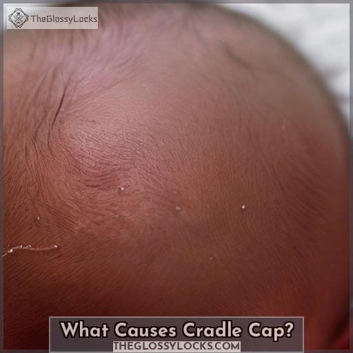 Can Cradle Cap Cause Hair Loss in Babies?