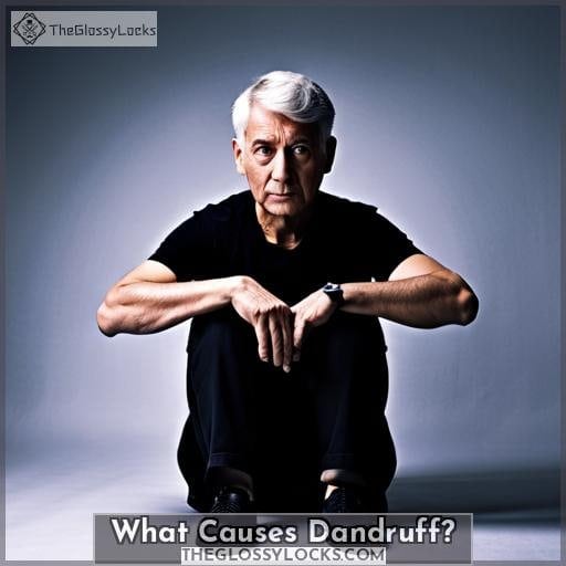 What Causes Dandruff? What Causes Dandruff?