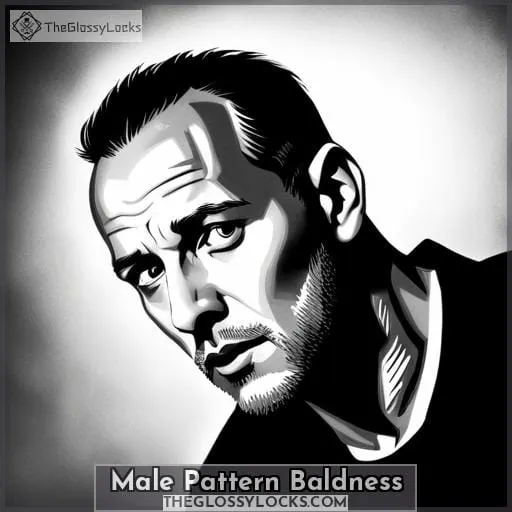 Male Pattern Baldness