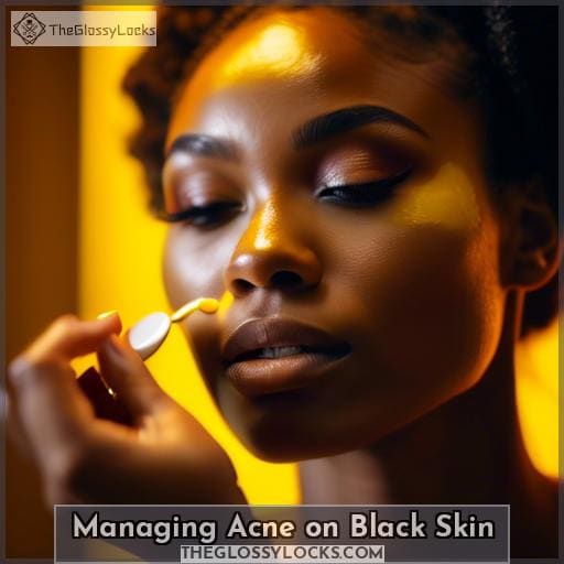 Managing Acne on Black Skin