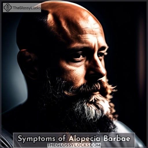 Symptoms of Alopecia Barbae