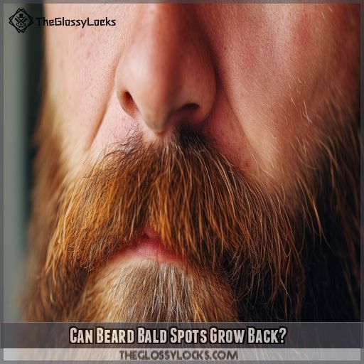Can Beard Bald Spots Grow Back