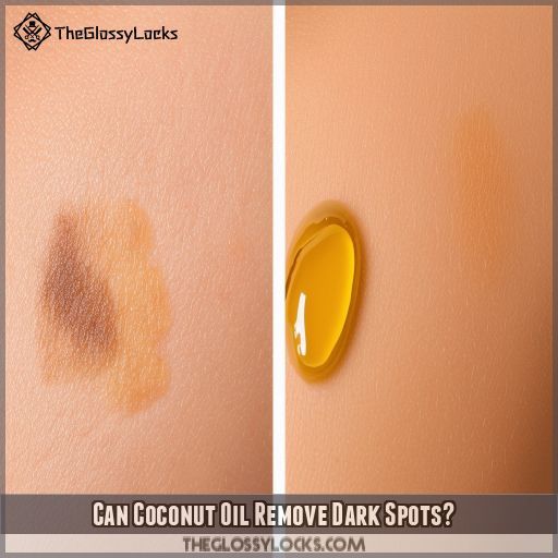 Can Coconut Oil Remove Dark Spots