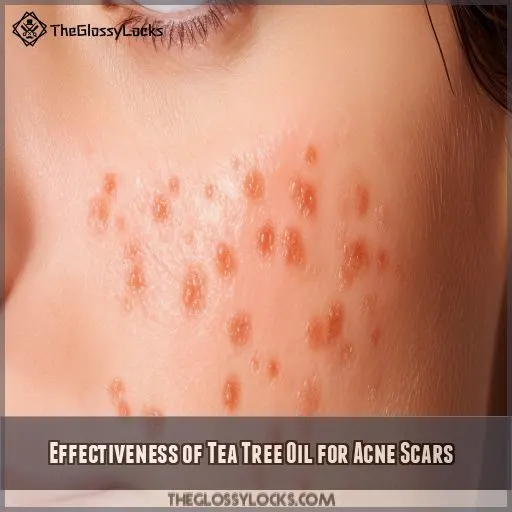 Effectiveness of Tea Tree Oil for Acne Scars