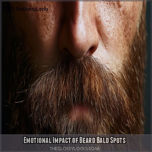 Emotional Impact of Beard Bald Spots