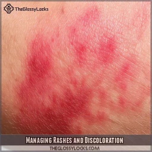 Managing Rashes and Discoloration