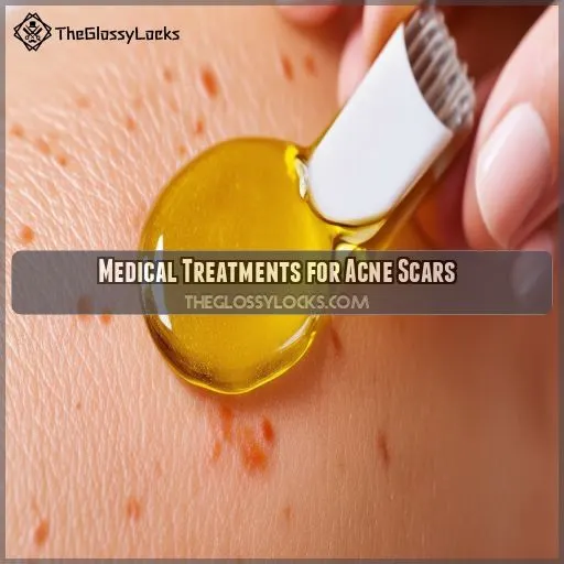 Medical Treatments for Acne Scars