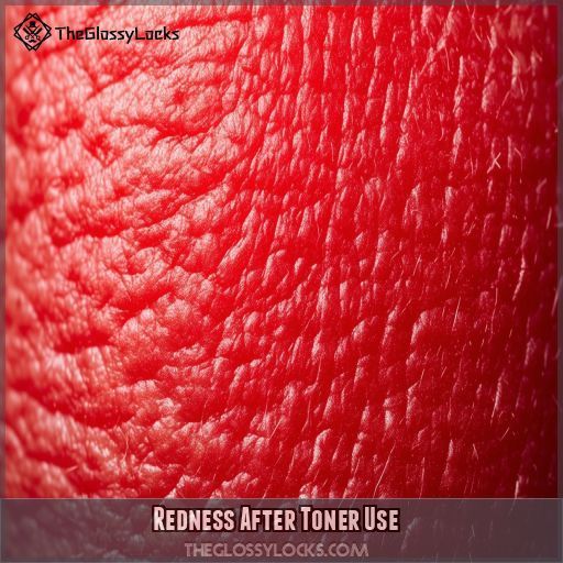 Redness After Toner Use