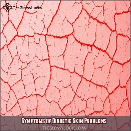 Symptoms of Diabetic Skin Problems