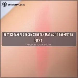 best cream for itchy stretch marks