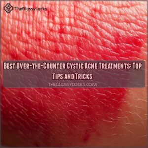 Best over the counter treatments for cystic acne