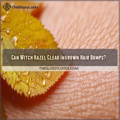 Can Witch Hazel Clear Ingrown Hair Bumps