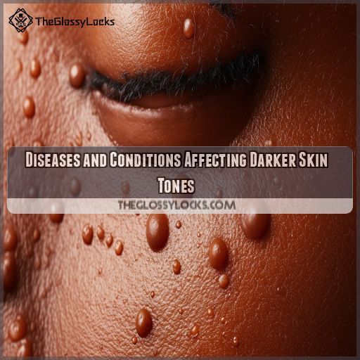 Diseases and Conditions Affecting Darker Skin Tones