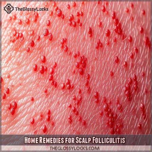 Home Remedies for Scalp Folliculitis