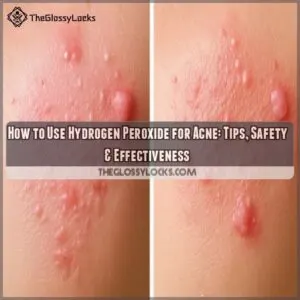 how to use hydrogen peroxide for acne