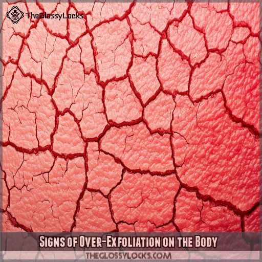 Signs of Over-Exfoliation on the Body