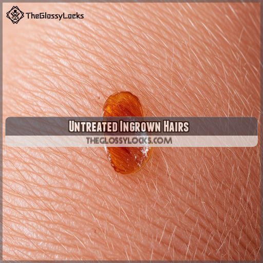 Untreated Ingrown Hairs
