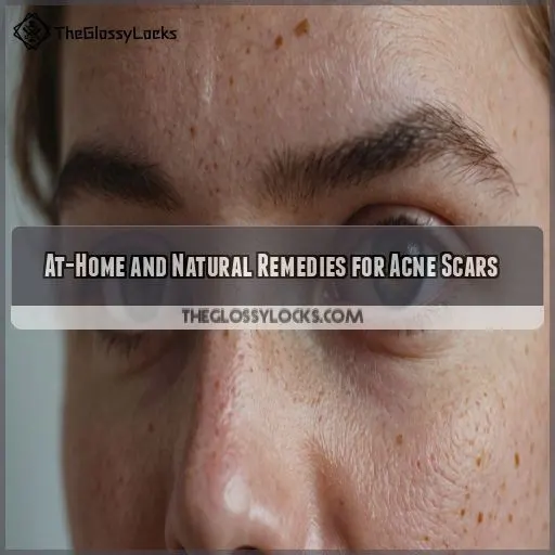 At-Home and Natural Remedies for Acne Scars