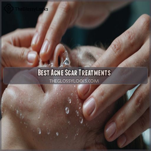 Best Acne Scar Treatments