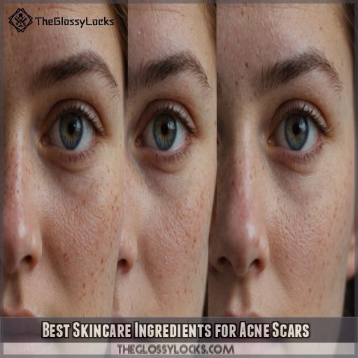 Best Skincare Ingredients for Acne Scars