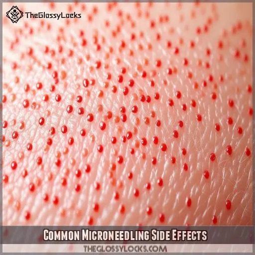 Common Microneedling Side Effects