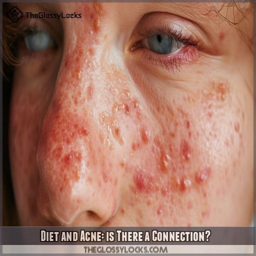 Diet and Acne: is There a Connection Diet and Acne: is There a Connection