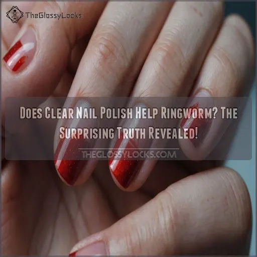 does clear nail polish help ringworm