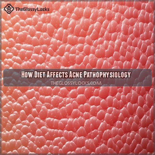 How Diet Affects Acne Pathophysiology How Diet Affects Acne Pathophysiology