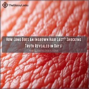 how long does an ingrown hair last