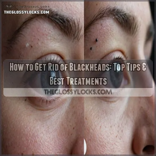 how to get rid of blackheads