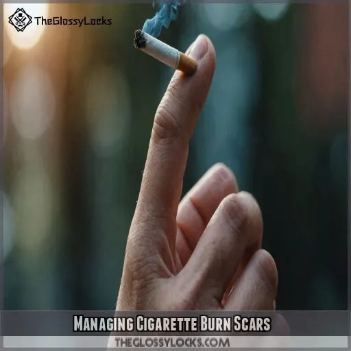 Managing Cigarette Burn Scars