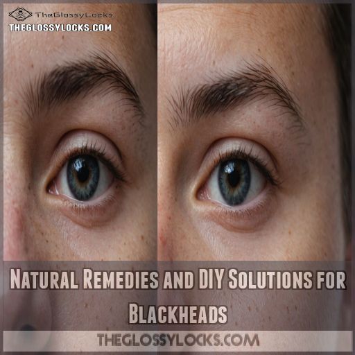 Natural Remedies and DIY Solutions for Blackheads