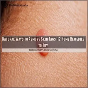 natural ways to remove skin tags