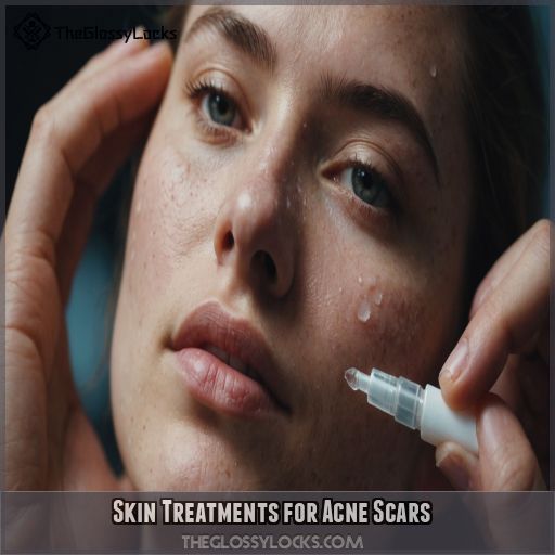 Skin Treatments for Acne Scars