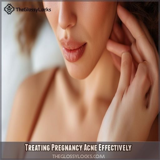 Treating Pregnancy Acne Effectively