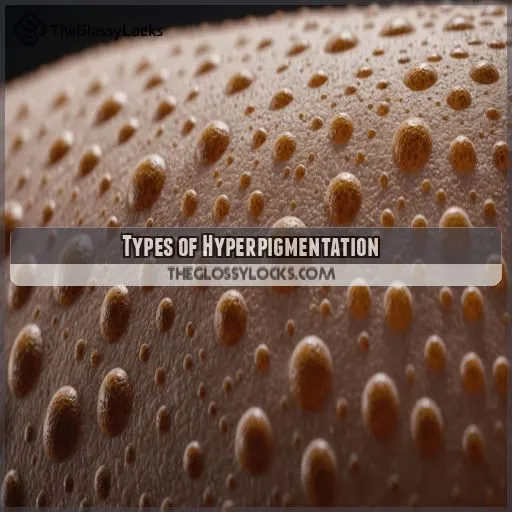 Types of Hyperpigmentation