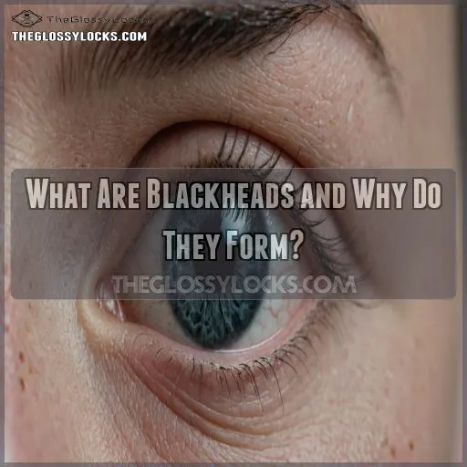 What Are Blackheads and Why Do They Form