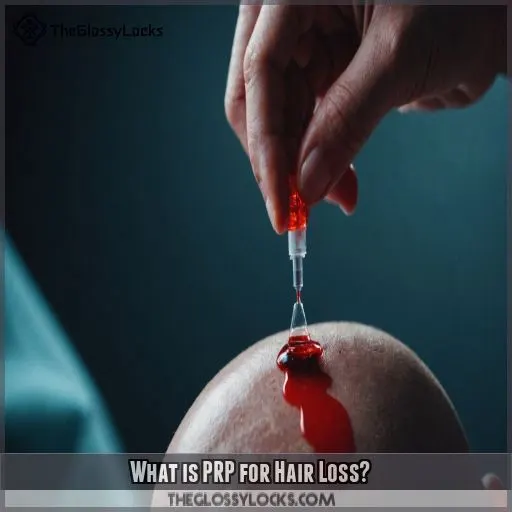 What is PRP for Hair Loss