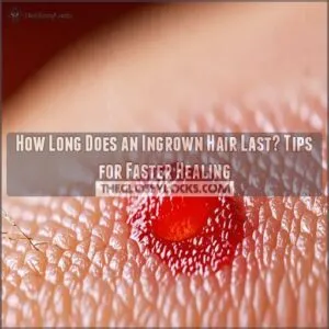 how long does an ingrown hair last