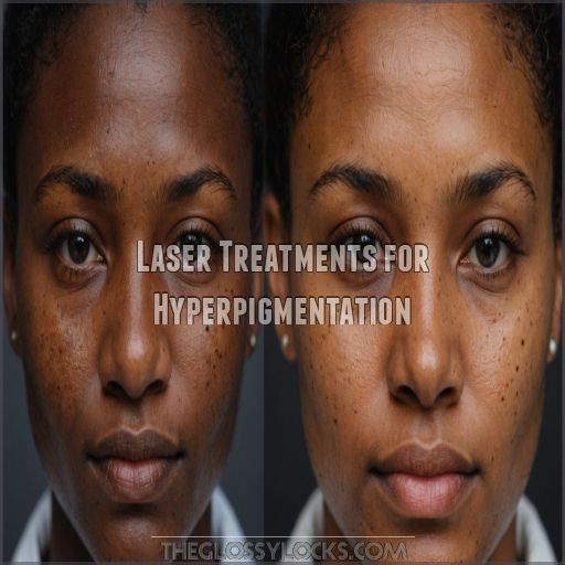 Laser Treatments for Hyperpigmentation