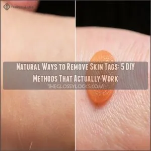 natural ways to remove skin tags