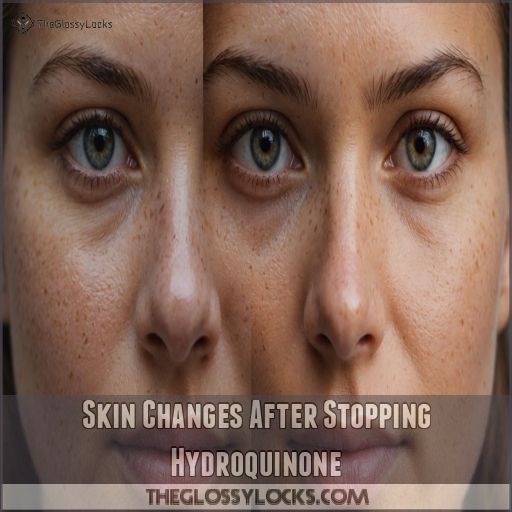 Skin Changes After Stopping Hydroquinone