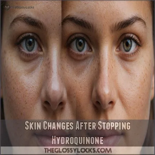 Skin Changes After Stopping Hydroquinone