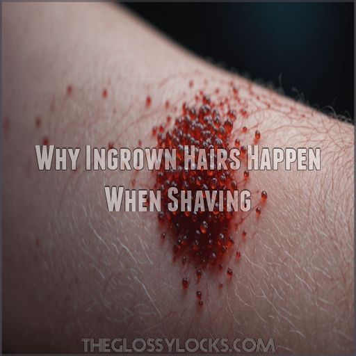 Why Ingrown Hairs Happen When Shaving