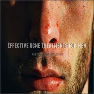 Effective Acne Treatments for Men