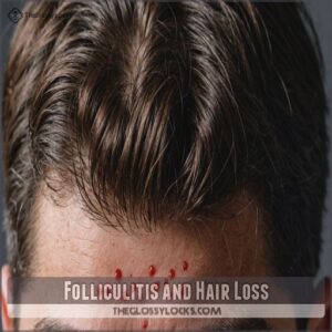 Folliculitis and Hair Loss